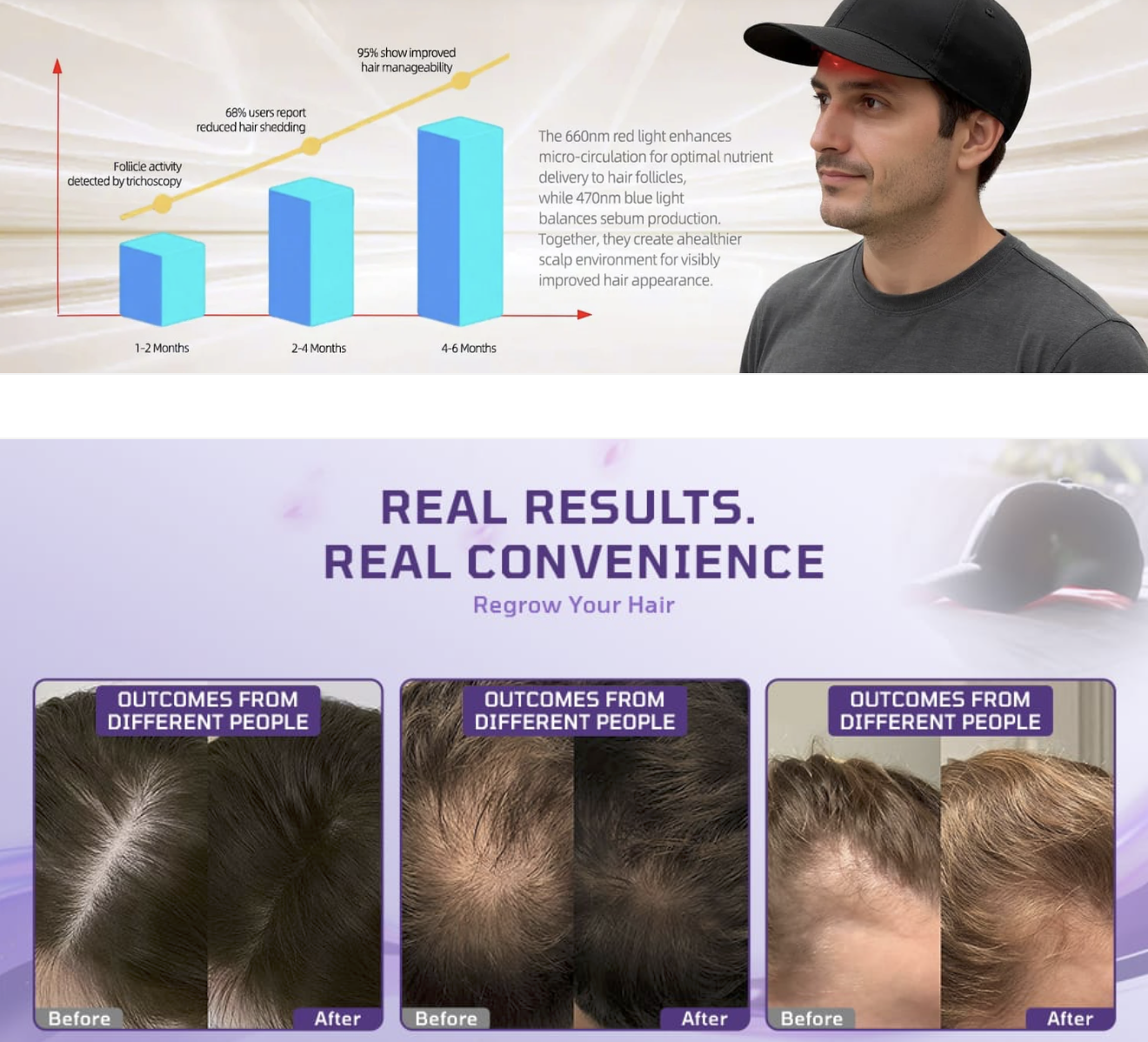 Laser Hair Growth Cap 3