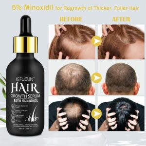 Sefudun Biotin Hair Growth Serum 2