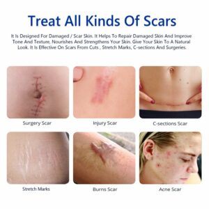 Elaimei Scar Removal Cream 3