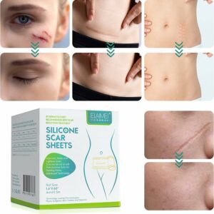Elaimei Silicone Scar Sheet 1.6 x 60 2