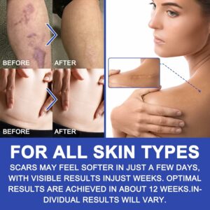 Elaimei Silicone Scar Sheet Transparent (4cm x 3m) 5