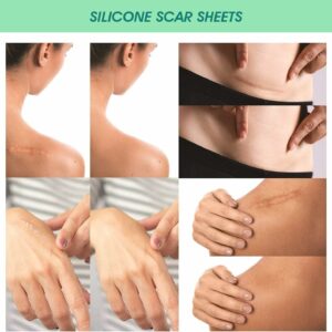 Elaimei Silicone Scar images