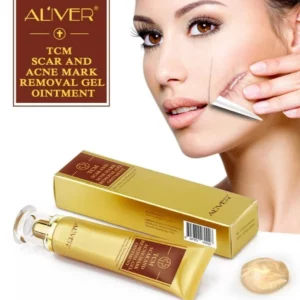 Aliver Acne Treatment & Scar Removal Cream 1