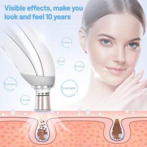 Portable Diamond Microdermabrasion effects