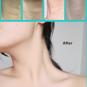 Neck Tape image 3