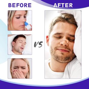 Sefudun Nasal Strips 3