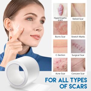 ELAIMEI Clear Silicone Scar Sheet
