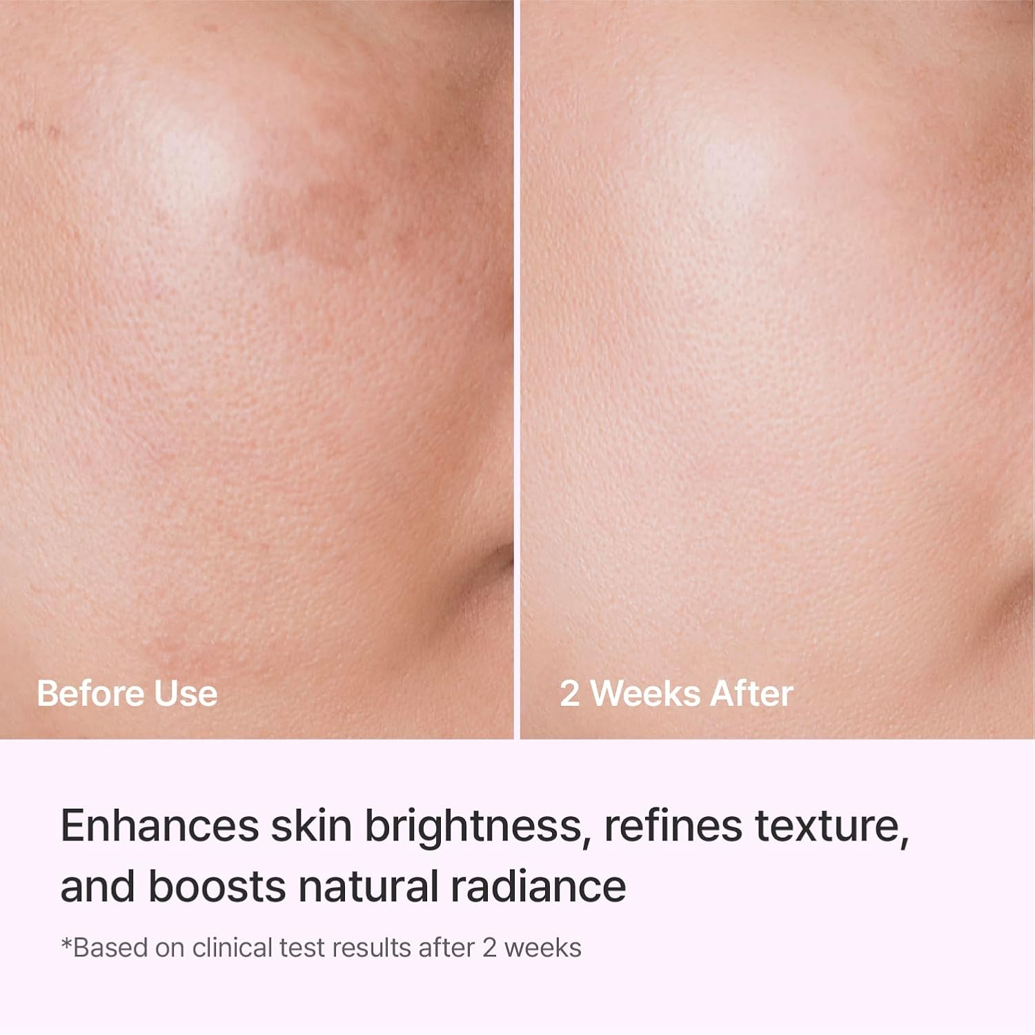 REJURAN Triple Radiance Ampoule4
