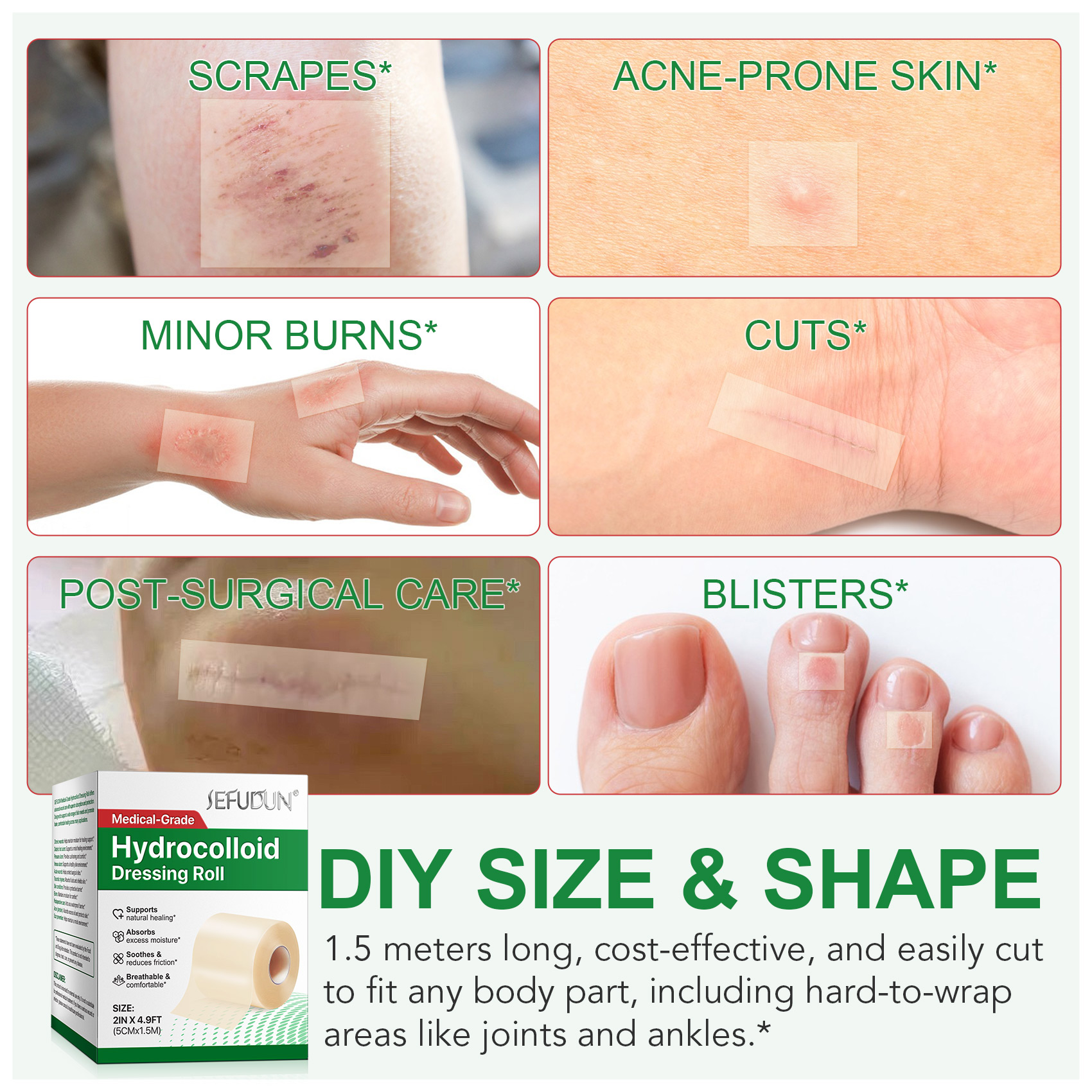 sefudun hydrocolloid dressing roll 2