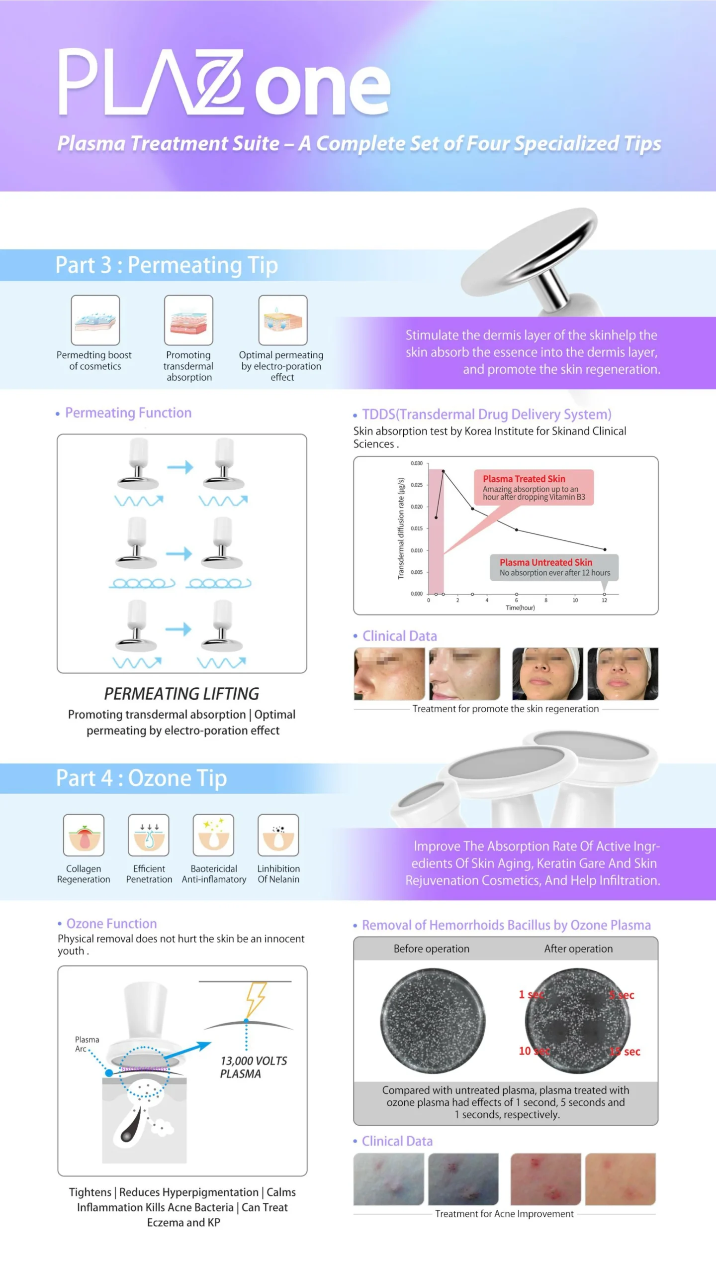 Plazone-replacement-tips2